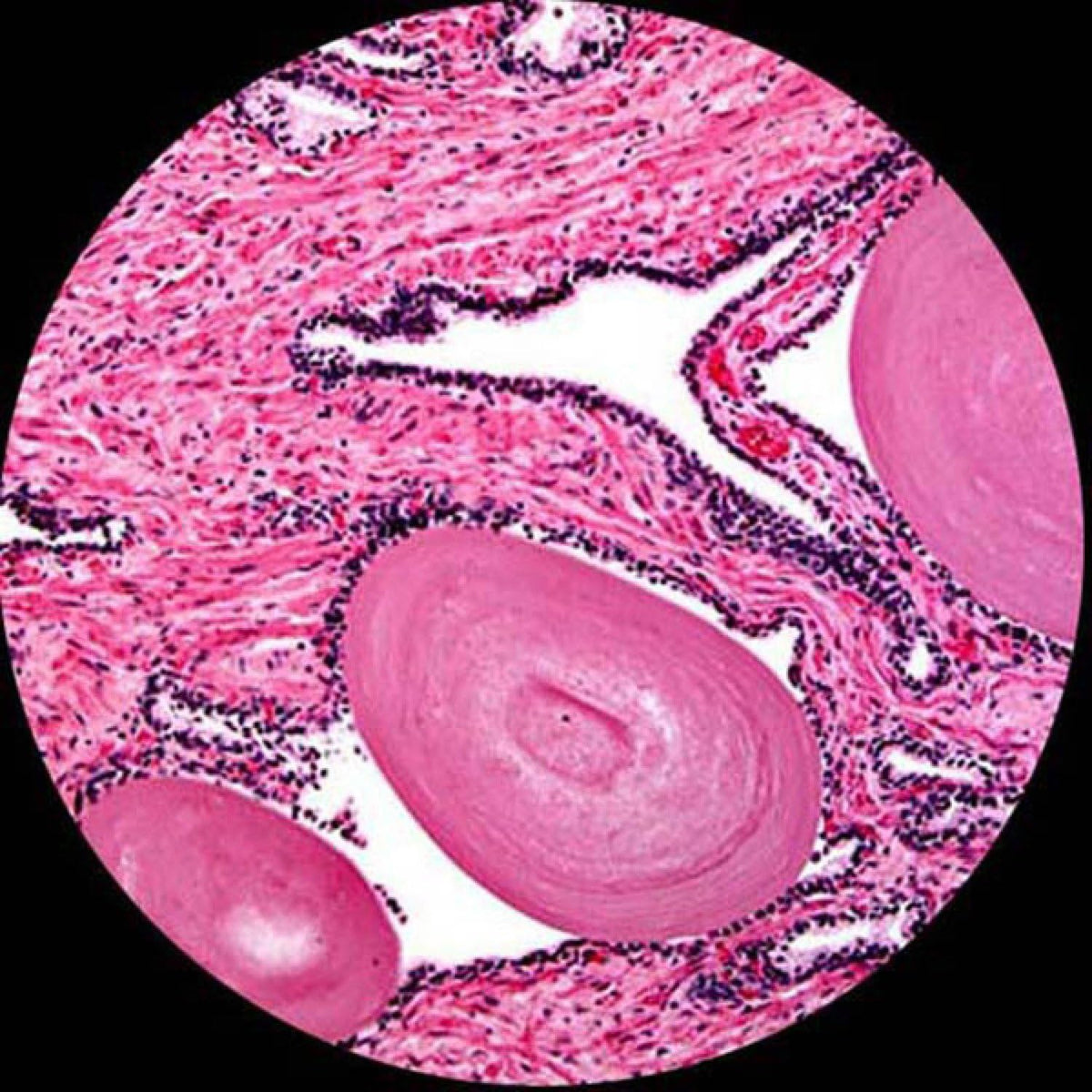 Binocular Compound Microscope, 40X-2000X Magnification, LED Illumination A1421
